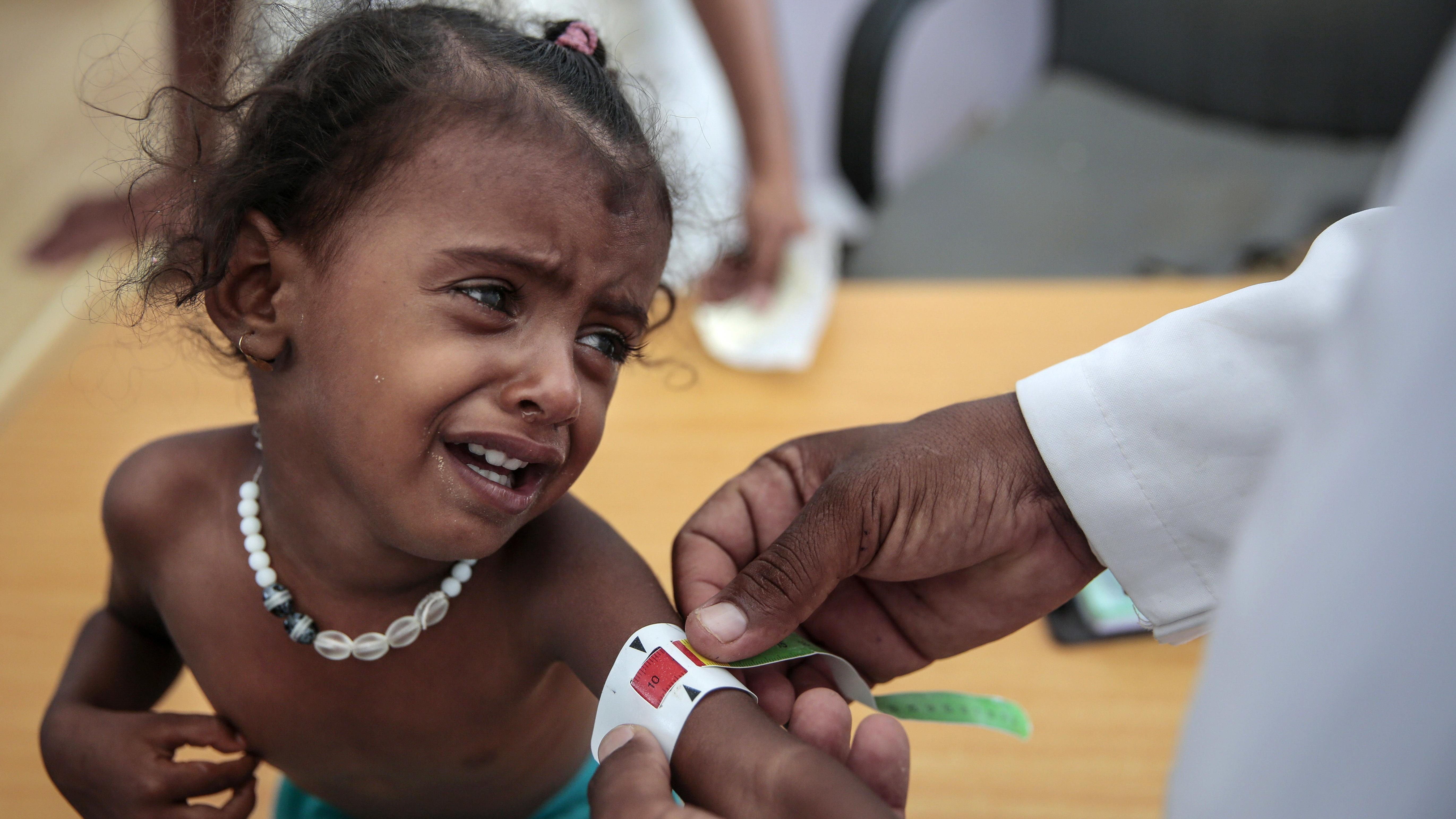 In this Oct. 1, 2018, photo, a doctor measures the arm of a malnourished girl at the Aslam Health Center, Hajjah, Yemen. A UN report says feeding a hungry planet is growing increasingly difficult as climate change and depletion of land and other resources undermines food systems.
