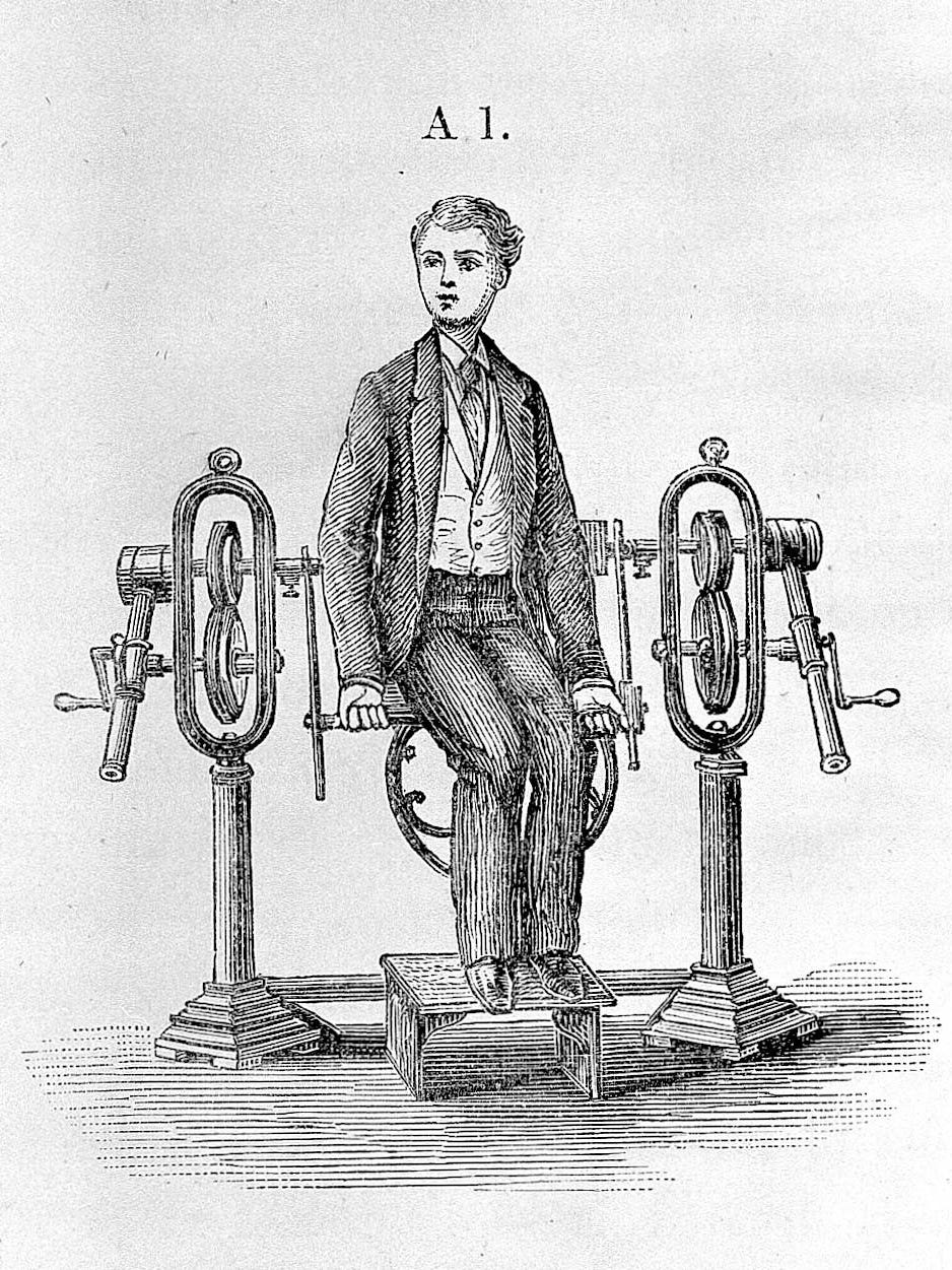 Another of Dr. Zander's machines was designed for "Flexion of the Forearms."