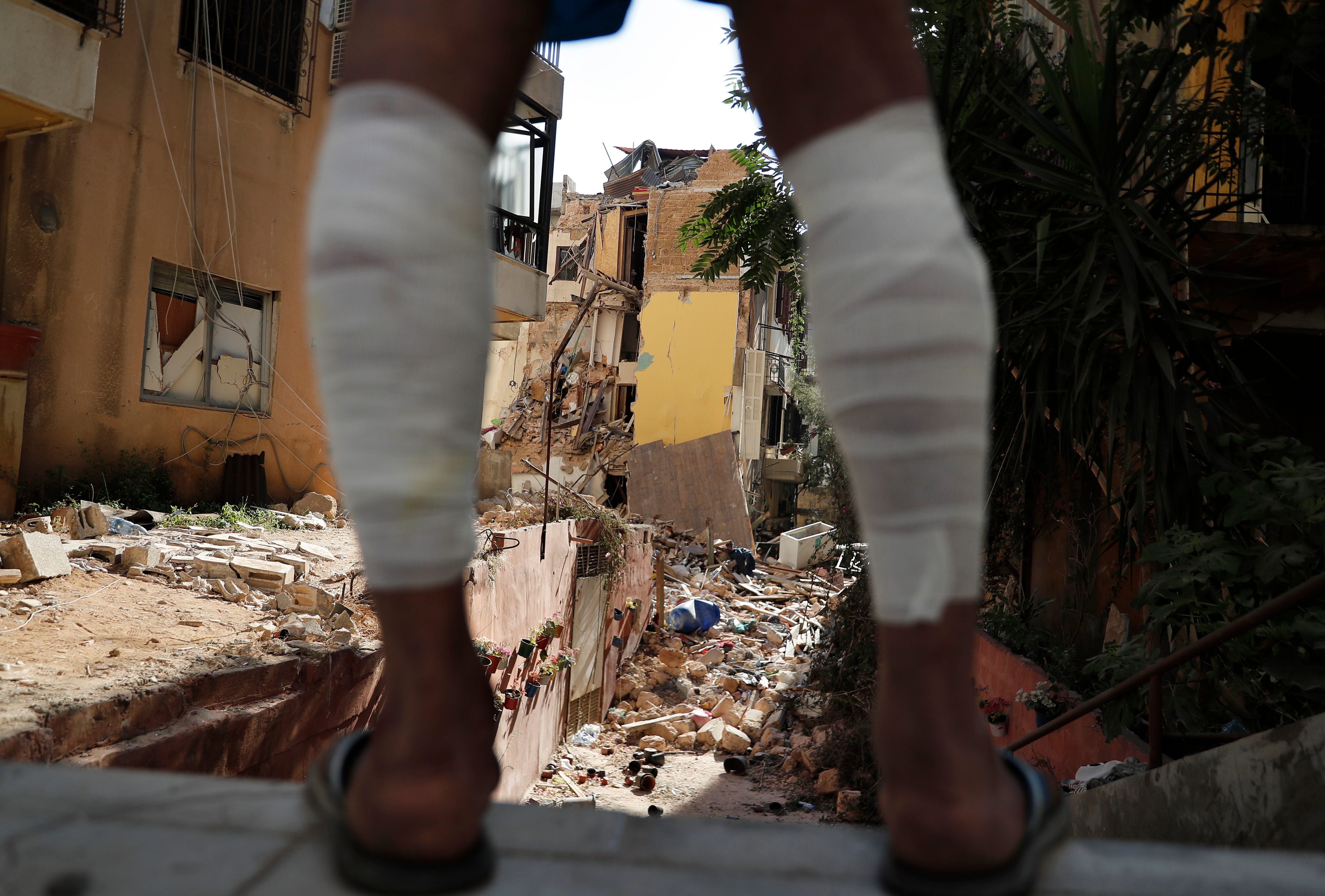 A man whose his legs were injured by Tuesday's explosion that hit the seaport of Beirut, looks on a destroyed house, in Beirut, Lebanon, Friday, Aug. 7, 2020. Rescue teams were still searching the rubble of Beirut's port for bodies on Friday, nearly three days after a massive explosion sent a wave of destruction through Lebanon's capital.