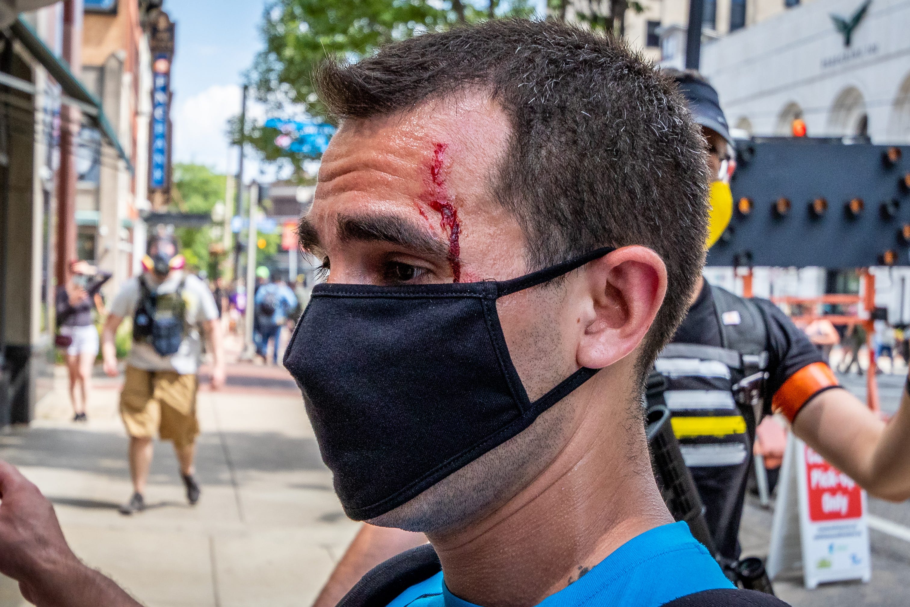 Hector Fox, from Ann Arbor, suffers from a cut during a counter-protest. Members of Proud Boys, antifa, and a local church clash with each other and local and Michigan State Police at Arcadia Creek Festival Plaza in Kalamazoo on August 15, 2020.