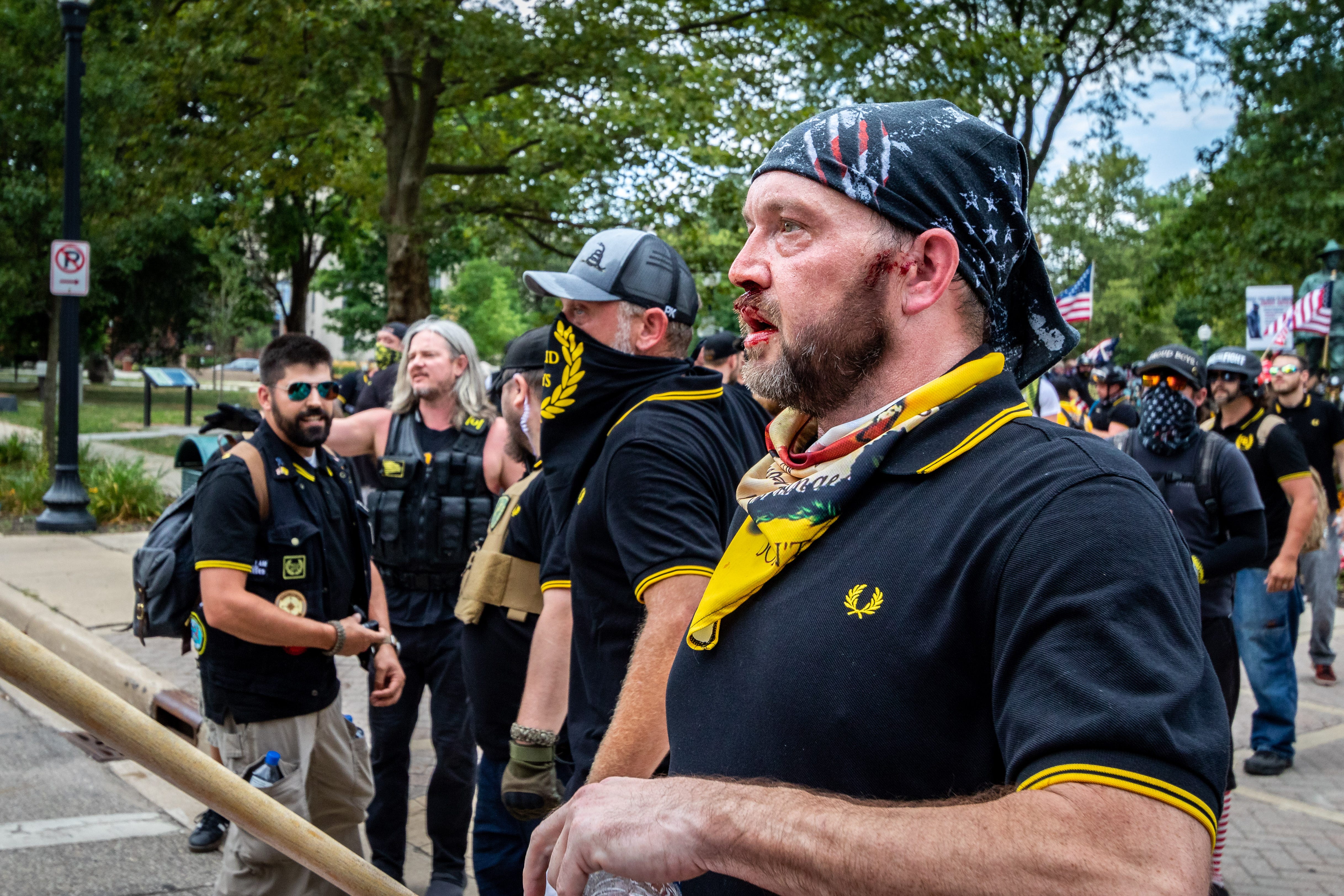 A Proud Boy has cuts on his face after clashing with counter-protestors.